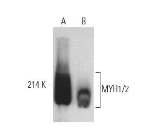 MYH1/2 Antibody (A4.1025)