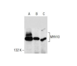 MYH10 Antibody (A-5) - Western Blotting - Image 260752 