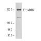 Myosin-2/MYH2 Antibody (6D596) - Western Blotting - Image 17607