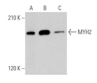 Myosin-2/MYH2 Antibody (6D596) - Western Blotting - Image 374137 