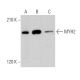 Myosin-2/MYH2 Antibody (6D596) - Western Blotting - Image 374137 