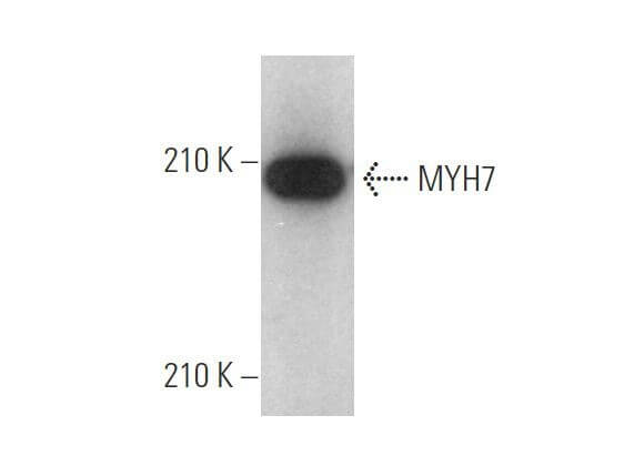 ma5ページ MYH7 Antibody (A4.840) | SCBT - Santa Cruz Biotechnology