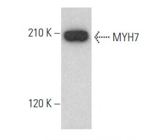 MYH7 Antibody (A4.840) - Western Blotting - Image 353984 