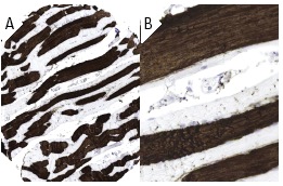 ma5ページ MYH7 Antibody (A4.951) | SCBT - Santa Cruz Biotechnology