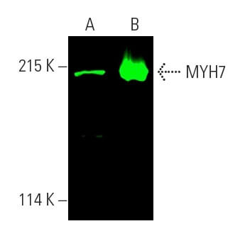ma5ページ myh7-antibody-a4-951-western-