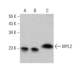 MYL2 Antibody (7C9) - Western Blotting - Image 376415 