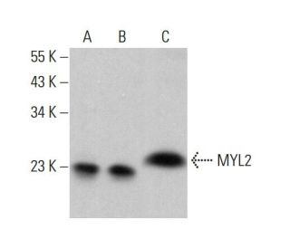 western blotting image from recommended MYL2 (7C9) monoclonal antibody replacement. Image 376415