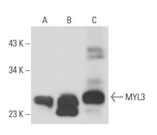 MYL3 Antibody (MLM527) - Western Blotting - Image 15575