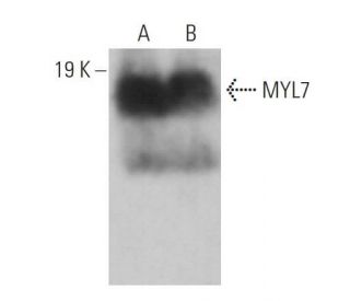 MYL7 Antibody (D-9) - Western Blotting - Image 359245 