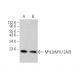 western blotting image from recommended MYL9/MYL12A/B (E-4) monoclonal antibody replacement. Image 354901