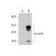 myocilin Antibody (C-1) - Western Blotting - Image 348603