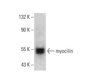 myocilin Antibody (C-1) - Western Blotting - Image 386846SAM Transcription Activation: SAM system utilizing dCas9-VP64, MS2-P65-HSF1, and sgRNA for precise gene transcription activation.