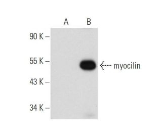 myocilin Antibody (F-12) - Western Blotting - Image 60015 
