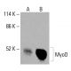 MyoD Antibody (E-1) - Western Blotting - Image 415896 