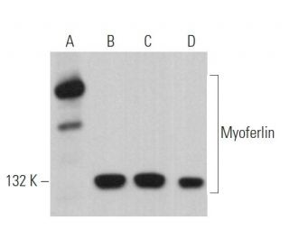 Myoferlin Antibody (D-11) - Western Blotting - Image 368724 