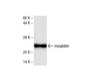 myoglobin Antibody (13) - Western Blotting - Image 136737