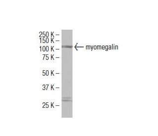 myomegalin Antibody (S-17) - Western Blotting - Image 34292 