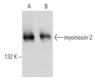 myomesin-2 Antibody (E-5) - Western Blotting - Image 354290