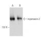 myomesin-2 Antibody (E-5) - Western Blotting - Image 354290