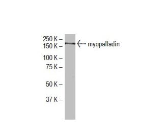 myopalladin Antibody (72-J) - Western Blotting - Image 33463The Double Nickase Plasmid features a U6 promoter for sgRNA expression, a 20 nt targeting sequence, and a gRNA scaffold to guide Cas9n. It includes a CBh promoter for Cas9n (D10A) and puromycin resistance, GFP for transfection verification, and nuclear localization signals (NLS). The 2A peptide allows co-expression of Cas9n and Puro from a single promoter, enabling precise genome editing with reduced off-target effects.