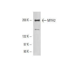 Myosin-2/MYH2 Antibody (6D596) - Western Blotting - Image 17607