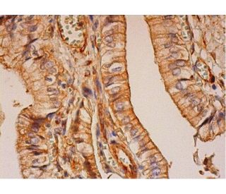 *my*ページ 5-lo-antibody-33-western-