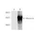 Myosin Ie Antibody (7A5) - Western Blotting - Image 347563 