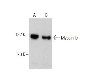 Myosin Ie Antibody (7A5) - Western Blotting - Image 384279 
