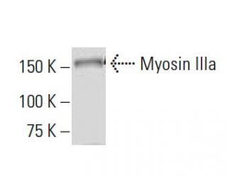 Myosin IIIa Antibody (RR-8) - Western Blotting - Image 34321