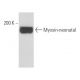 Myosin-neonatal Antibody (N1.551) - Western Blotting - Image 17490