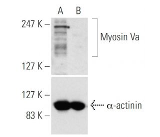 Myosin VA siRNA (h): sc-35995. Western blot analysis of Myosin VA expression in non-transfected control (A) and Myosin VA 
