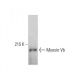 Myosin Vb Antibody (18) - Western Blotting - Image 387336