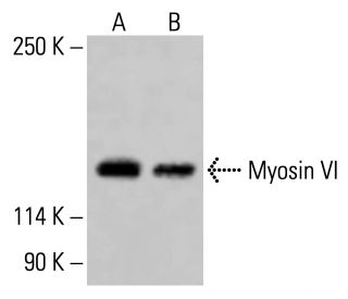 Myosin VI Antibody (A-9) - Western Blotting - Image 415277 