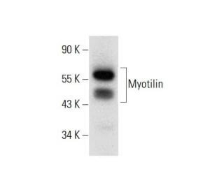 Myotilin Antibody (E-10) - Western Blotting - Image 299347 