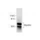 Myotilin Antibody (E-10) - Western Blotting - Image 300594 
