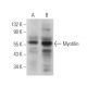 Myotilin Antibody (E-10) - Western Blotting - Image 369963