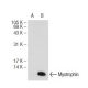 Myotrophin Antibody (B-9) - Western Blotting - Image 108881