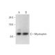 Myotrophin Antibody (B-9) - Western Blotting - Image 331186 