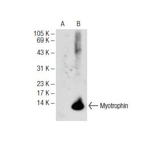 Myotrophin Antibody (F-10) - Western Blotting - Image 72581