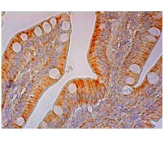 myotubularin Antibody (F-1) - Immunohistochemistry - Image 298931 