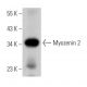 Myozenin 2 Antibody (G-2) - Western Blotting - Image 364653 