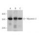 Myozenin 2 Antibody (G-2) - Western Blotting - Image 364656