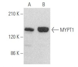 western blotting image from recommended MYPT1 (C-6) monoclonal antibody replacement. Image 354077
