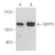 Questo anticorpo policlonale è stato sospeso. Consulta il nostro anticorpo monoclonale <a href="mypt1-antibody-c-6">MYPT1 (C-6)</a> raccomandato (sono riportati i dati del campione). western blotting image from recommended MYPT1 (C-6) monoclonal antibody replacement. Image 354077