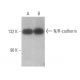 western blotting image from recommended N/R-cadherin (H-4) monoclonal antibody replacement. Image 350013