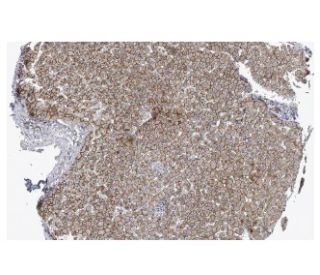 N-cadherin Antibody (D-4) - Immunohistochemistry - Image 114236 