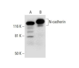 N-cadherin Antibody (H-2) - Western Blotting - Image 299188 