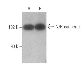 western blotting image from recommended N/R-cadherin (H-4) monoclonal antibody replacement. Image 350013