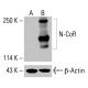 N-CoR Antibody (E-6): sc-518134. Western blot analysis of N-CoR expression in untreated (A) and chemically-treated (B) HeLa whole cell lysates. Detection reagent used: m-IgGκ BP-HRP: sc-516102. β-Actin (C4): sc-47778 used as loading control. Detection reagent used: m-IgG Fc BP-HRP: sc-525409. N-CoR Antibody (E-6) - Western Blotting - Image 416492
