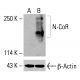 N-CoR Antibody (E-6): sc-518134. Western blot analysis of N-CoR expression in untreated (A) and chemically-treated (B) K-562 whole cell lysates. Detection reagent used: m-IgGκ BP-HRP: sc-516102. β-Actin (C4): sc-47778 used as loading control. Detection reagent used: m-IgG Fc BP-HRP: sc-525409. N-CoR Antibody (E-6) - Western Blotting - Image 416493